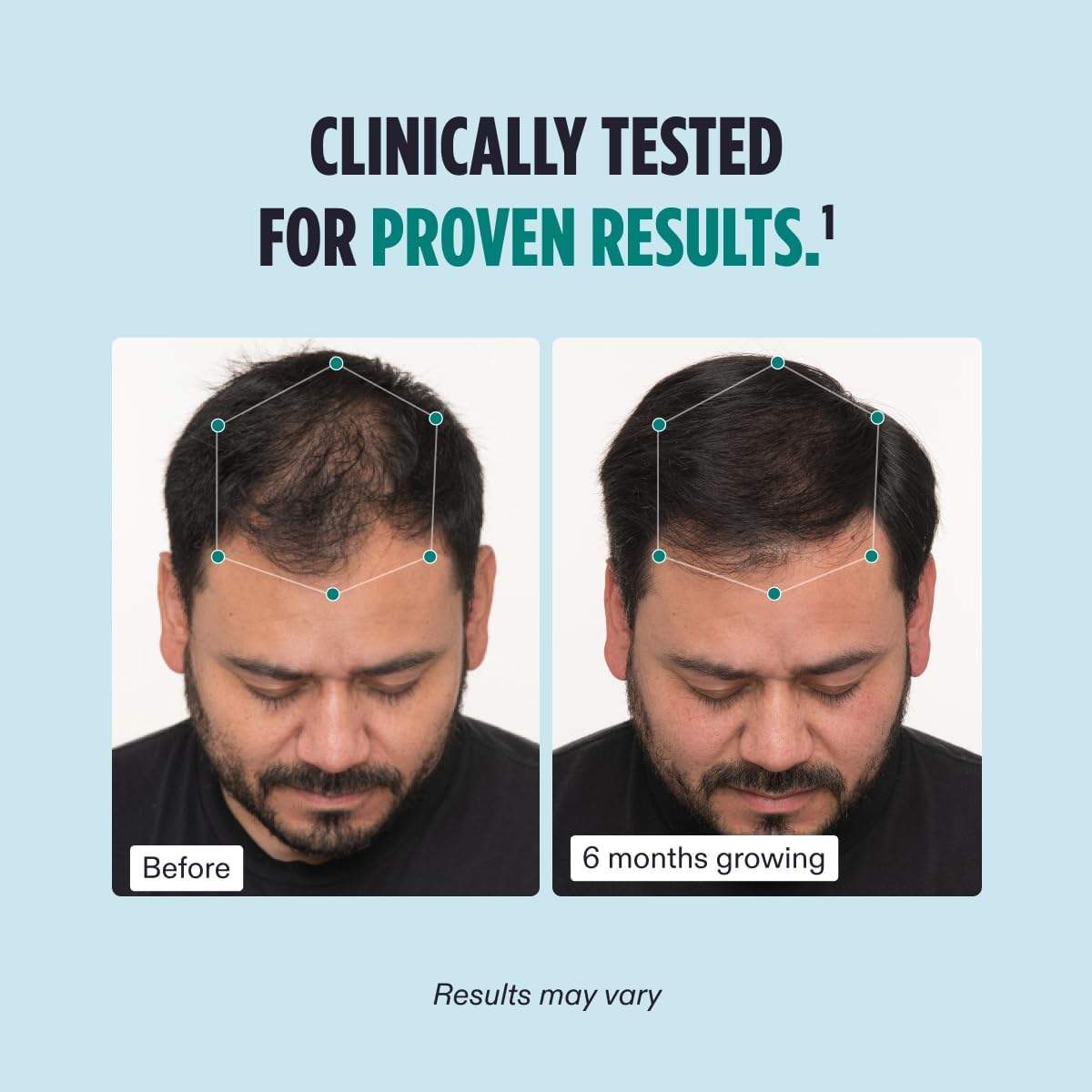 Nutrafol Mens Hair Growth Supplements, Clinically Tested for Visibly Thicker Hair and Scalp Coverage, Dermatologist Recommended - 1 Month Supply